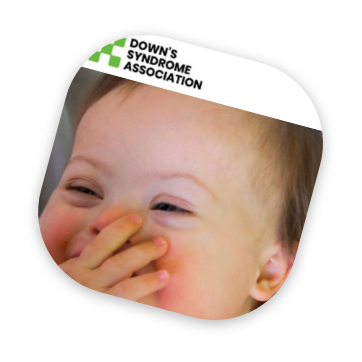downs syndrome charity
